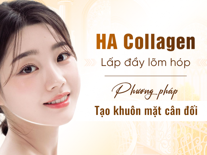 Cấy HA Collagen Làm Đầy Má Tại Oshun Beauty Clinic