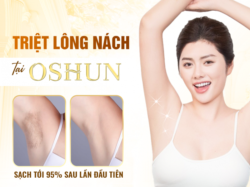 Triệt Lông Nách Tại Oshun Có Hết Vĩnh Viễn Không ?