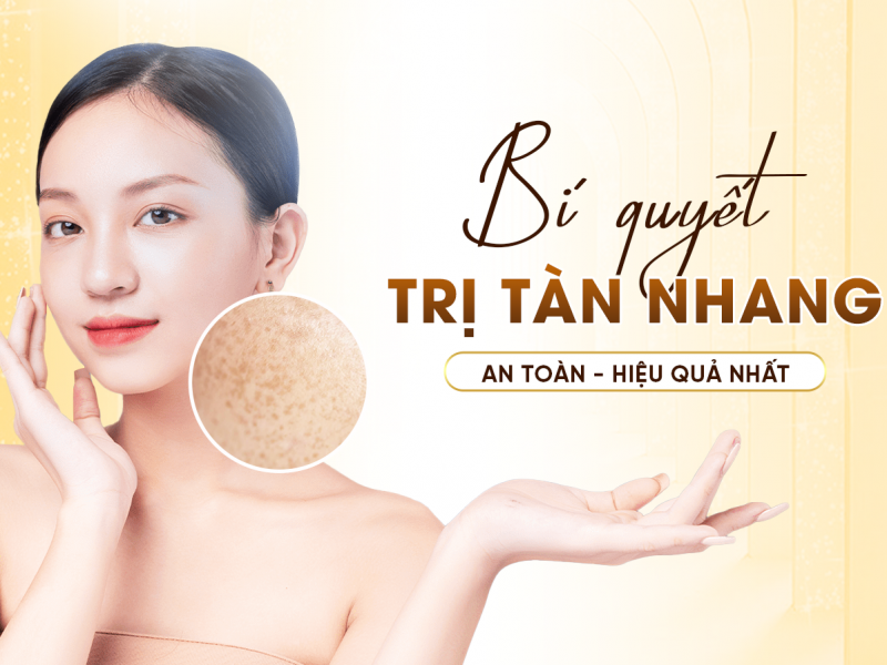 Điều Trị Tàn Nhang - Các Phương Pháp Điều Hiệu Quả Nhất