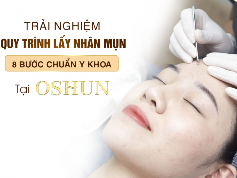 Lấy Nhân Mụn Chuẩn Y Khoa Cho Làn Da Sáng Mịn Tại Biên Hòa