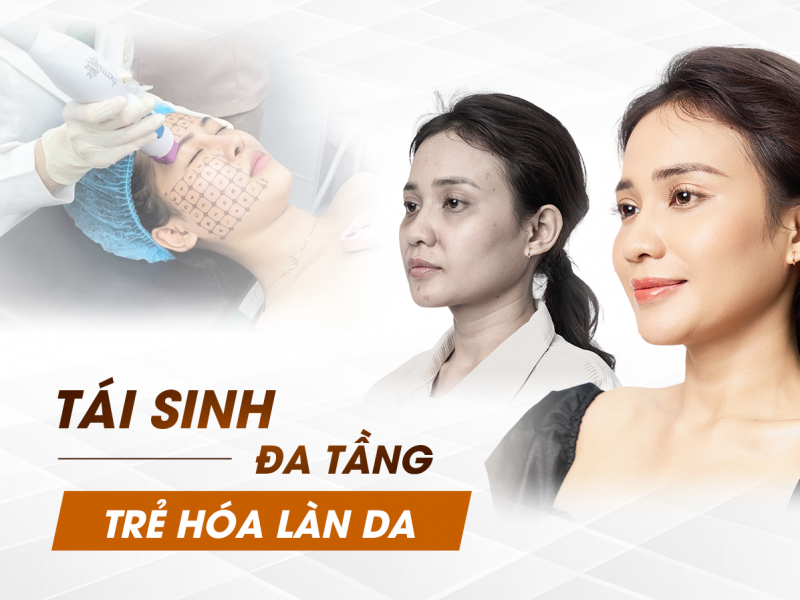 Tái Cấu Trúc Đa Tầng Công Nghệ Trẻ Hóa Cấp Tốc Tại Biên Hòa