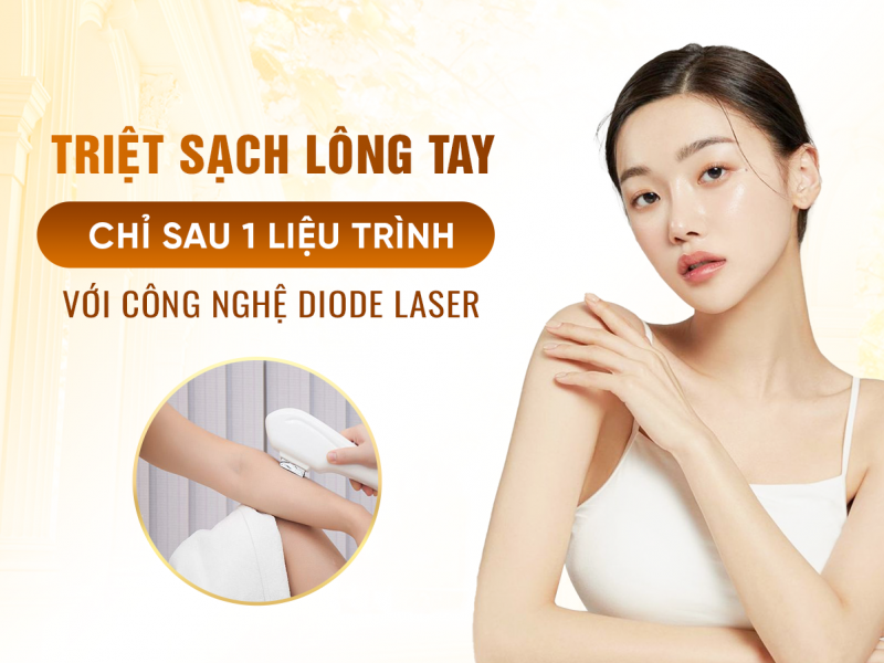 Triệt Lông Full Tay An Toàn Hiệu Quả Tại TMV Oshun