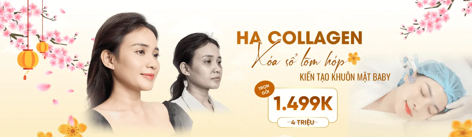 Can Chinh Guong Mat Ha Collagen