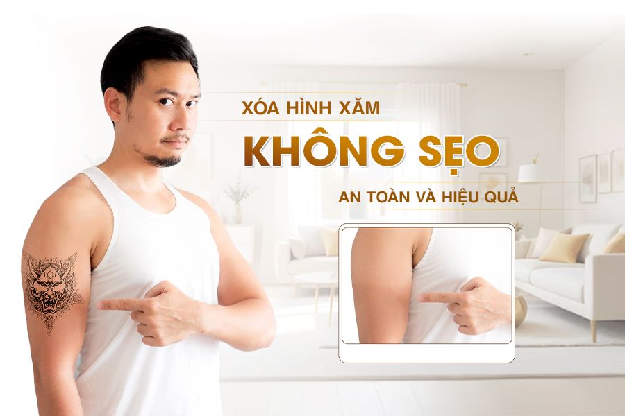 xóa hình xăm không sẹo