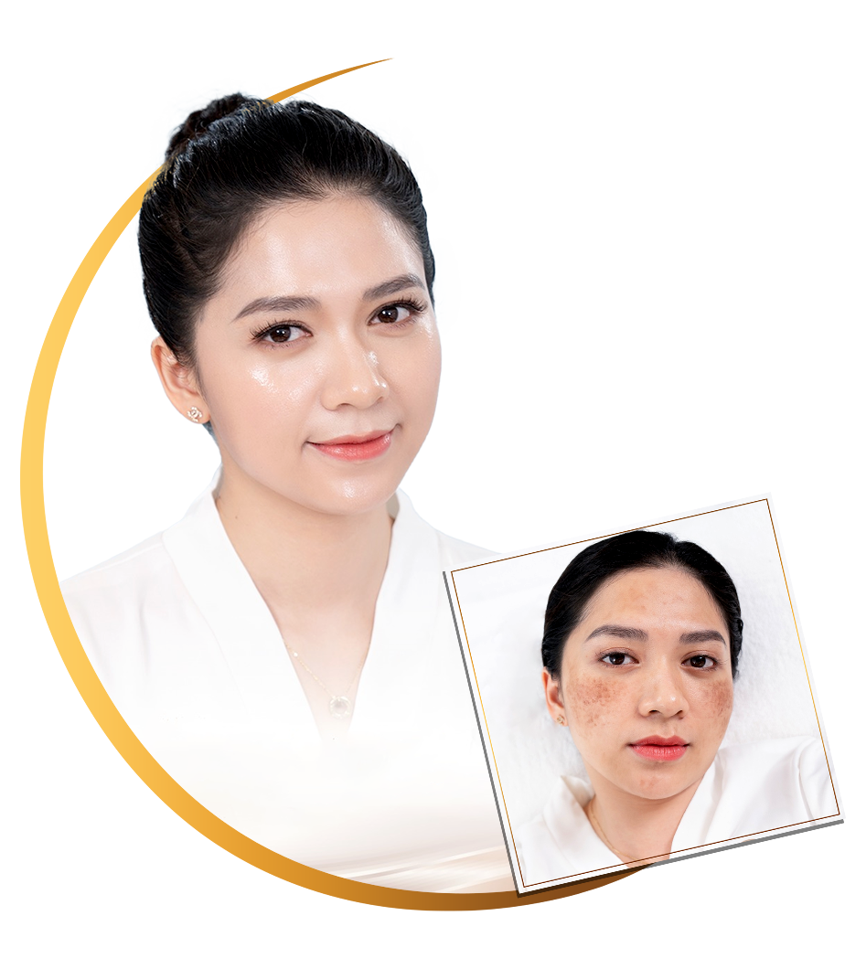 Dieu Tri Nam CNC Tai Oshun